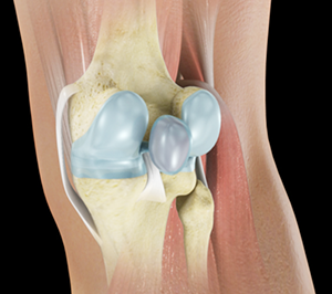 Baker’s Cyst