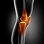 Chondral/Osteochondral Injuries of the Knee More