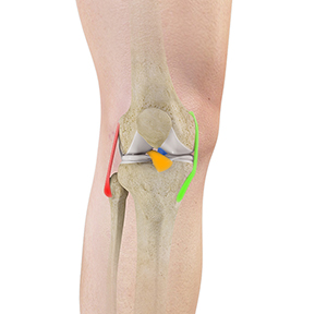  Knee Ligament Reconstruction 
