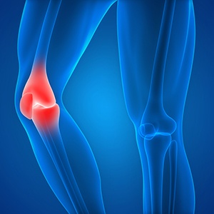 Knee Sports Injuries 