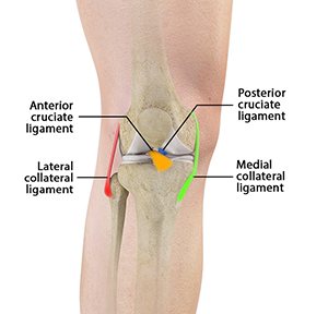 Multiligament Knee Injuries 