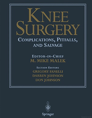Knee Surgery - M. Mike Malek, M.D.